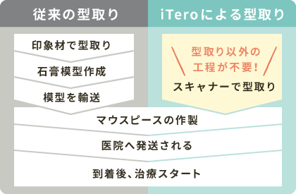 iTeroを使用した治療の流れ