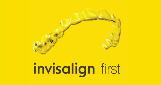 invisalign first