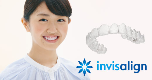 invisalign